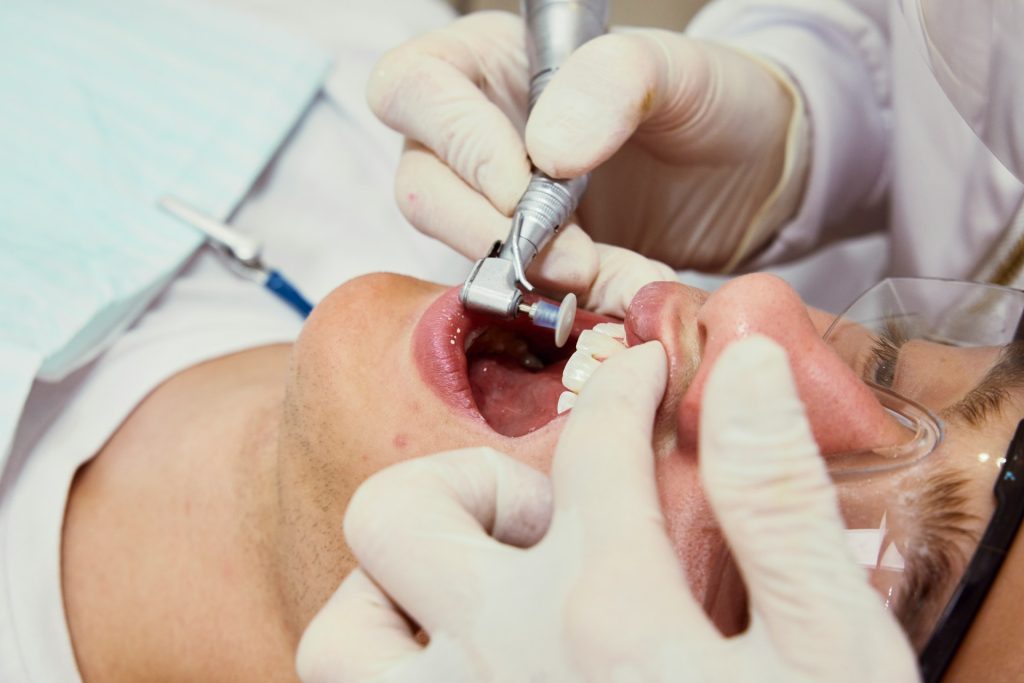 First Dental Implant