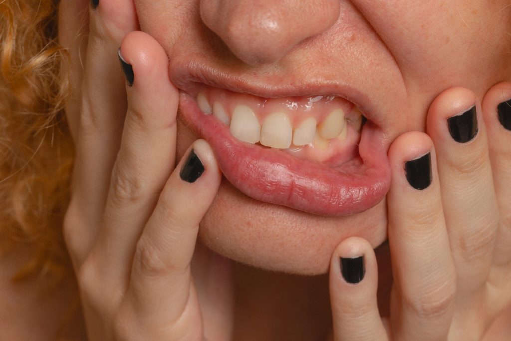 Advancing Periodontal Disease