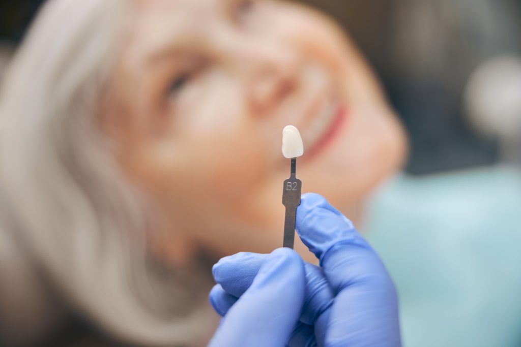 Ceramic Dental Crowns