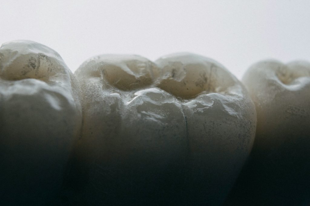 cracked tooth