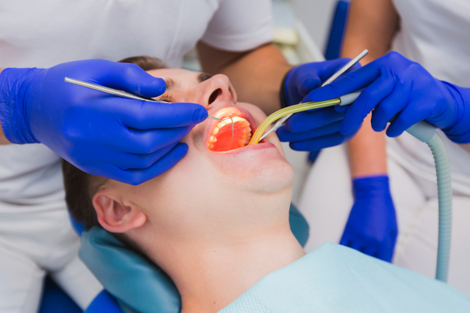 root canal therapy
