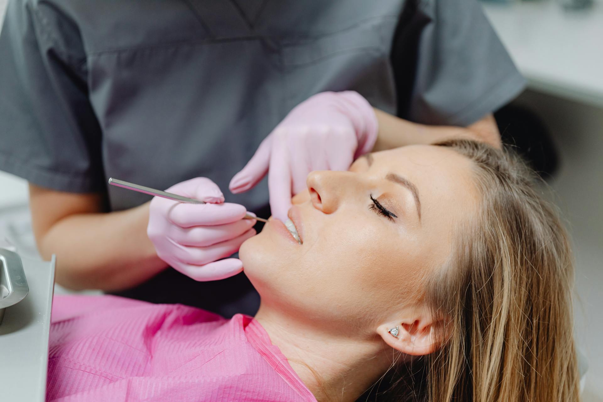 Dental Fillings